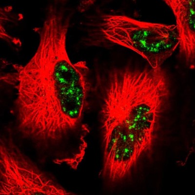 Immunocytochemistry/Immunofluorescence: CCNJL Antibody [NBP2-14461] - Immunofluorescent staining of human cell line U-251 MG shows localization to nuclear speckles.