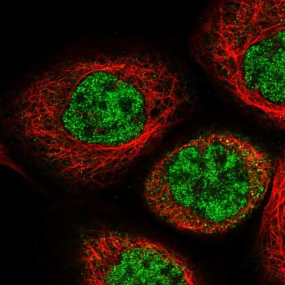 Immunocytochemistry/Immunofluorescence: IPMK Antibody [NBP1-89426] - Immunofluorescent staining of human cell line A-431 shows localization to nucleoplasm.