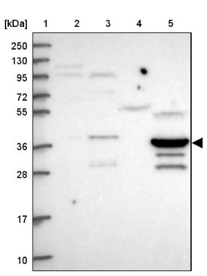 Western Blot: C5orf45 Antibody [NBP2-14417] - Lane 1: Marker  [kDa] 250, 130, 95, 72, 55, 36, 28, 17, 10.  Lane 2: Human cell line RT-4.  Lane 3: Human cell line U-251MG sp.  Lane 4: Human plasma (IgG/HSA depleted).  Lane 5: Human liver tissue