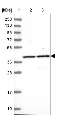 Western Blot: C3orf37 Antibody [NBP2-14410] - Lane 1: Marker  [kDa] 250, 130, 95, 72, 55, 36, 28, 17, 10.  Lane 2: Human cell line RT-4.  Lane 3: Human cell line U-251MG sp