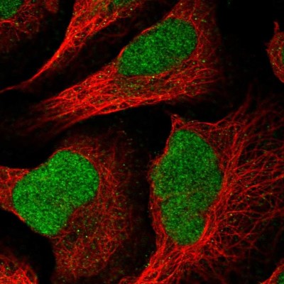 Immunocytochemistry/Immunofluorescence: C3orf37 Antibody [NBP2-14410] - Immunofluorescent staining of human cell line U-2 OS shows localization to nucleus.