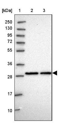 Western Blot: C2orf49 Antibody [NBP2-14404] - Lane 1: Marker  [kDa] 250, 130, 95, 72, 55, 36, 28, 17, 10.  Lane 2: Human cell line RT-4.  Lane 3: Human cell line U-251MG sp