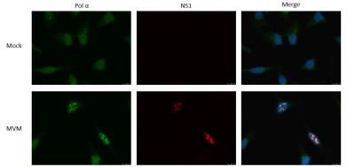 Immunofluorescence: DNA polymerase alpha Antibody [NBP1-47256] - Analysis of DNA polymerase alpha in mouse A9 fibroblasts that were either Mock infected or were infected with the parvovirus MVM (Minute Virus of Mice). Image courtesy of Dr. Matt Fuller at University of Missouri-Columbia.