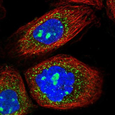 Immunocytochemistry/Immunofluorescence: AGPS Antibody [NBP1-89241] - Staining of human cell line A-431 shows localization to nucleoli & peroxisomes.