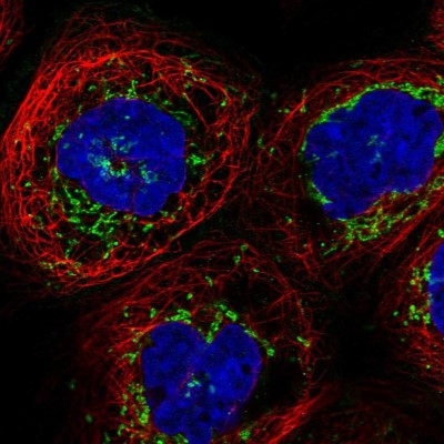 Immunocytochemistry/Immunofluorescence: ALS2CR15 Antibody [NBP1-90185] - Immunofluorescent staining of human cell line A-431 shows localization to mitochondria.