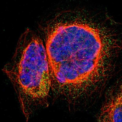 Immunocytochemistry/Immunofluorescence: ARFGAP3 Antibody [NBP1-88842] - Immunofluorescent staining of human cell line A-431 shows localization to cytosol.