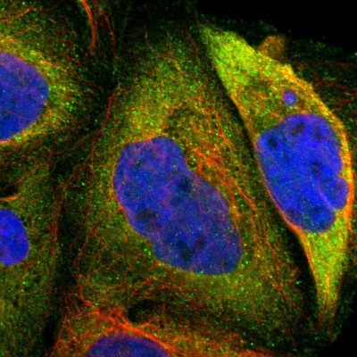 Immunocytochemistry/Immunofluorescence: CRLF3 Antibody [NBP1-84382] - Immunofluorescent staining of human cell line A-431 shows localization to plasma membrane & cytosol.