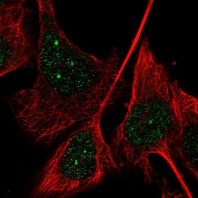 Immunocytochemistry/Immunofluorescence: CRISP2 Antibody [NBP1-85452] - Staining  of human cell line U-251MG shows positivity in nucleus.