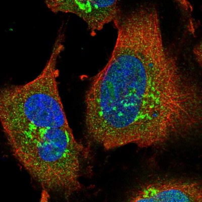 Immunocytochemistry/Immunofluorescence: COL4A3BP Antibody [NBP1-85681] - Immunofluorescent staining of human cell line U-251 MG shows localization to nucleoplasm & the Golgi apparatus.