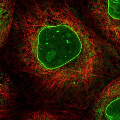 Immunocytochemistry/Immunofluorescence: RNA binding motif protein, X-linked 2 Antibody [NBP1-85650] - Immunofluorescent staining of human cell line A-431 shows localization to nucleoli & nuclear membrane.