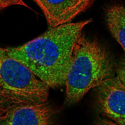 Immunocytochemistry/Immunofluorescence: OTUD6B Antibody [NBP1-85653] - Immunofluorescent staining of human cell line A-431 shows localization to cytosol & the Golgi apparatus.