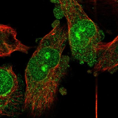 Immunocytochemistry/Immunofluorescence: C3orf39 Antibody [NBP1-89205] - Staining of human cell line U-251MG shows positivity in nucleoli and nuclear membrane.