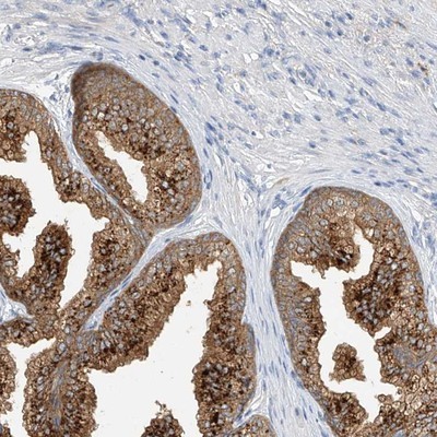 Immunohistochemistry-Paraffin: C3orf39 Antibody [NBP1-89205] - Staining of human prostate shows strong cytoplasmic positivity in glandular cells.