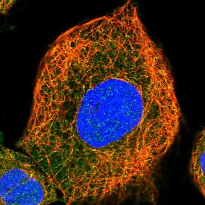 Immunocytochemistry/Immunofluorescence: AIDA Antibody [NBP1-88323] - Immunofluorescent staining of human cell line A-431 shows localization to cytosol & microtubules.
