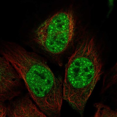Immunocytochemistry/Immunofluorescence: IP3KC Antibody [NBP2-49068] - Immunofluorescent staining of human cell line U-2 OS shows localization to nuclear speckles.