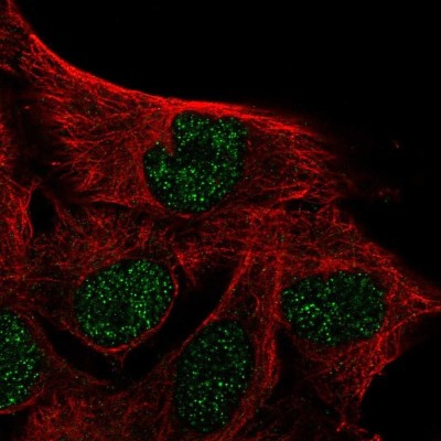 Immunocytochemistry/Immunofluorescence: IQCD Antibody [NBP2-48916] - Staining of human cell line SK-MEL-30 shows localization to nucleus.