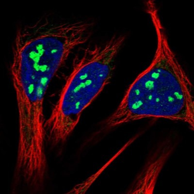Immunocytochemistry/Immunofluorescence: RRP15 Antibody [NBP1-84522] - Immunofluorescent staining of human cell line U-2 OS shows localization to nucleoli & mitochondria.