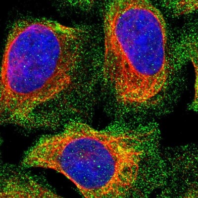 Immunocytochemistry/Immunofluorescence: PPP3CC Antibody [NBP1-86656] - Immunofluorescent staining of human cell line U-2 OS shows localization to vesicles.