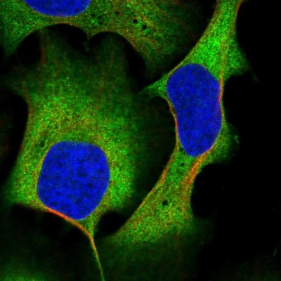 Immunocytochemistry/Immunofluorescence: AKAP10 Antibody [NBP1-85314] - Immunofluorescent staining of human cell line U-2 OS shows localization to plasma membrane & cytosol.