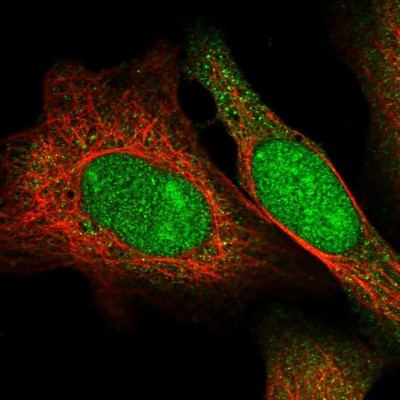 Immunocytochemistry/Immunofluorescence: TDRD1 Antibody [NBP1-84349] - Staining of human cell line U-2 OS shows positivity in nucleus, nucleoli and cytoplasm.