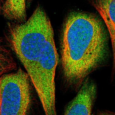 Immunocytochemistry/Immunofluorescence: DHX36 Antibody [NBP1-84286] - Immunofluorescent staining of human cell line U-2 OS shows localization to cytosol.