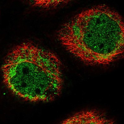 Immunocytochemistry/Immunofluorescence: HIGD1A Antibody [NBP1-84153] - Immunofluorescent staining of human cell line A-431 shows localization to nucleoplasm & mitochondria.