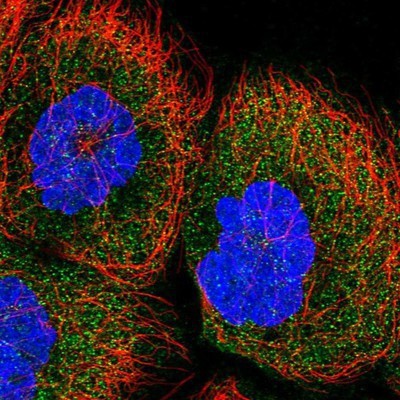 Immunocytochemistry/Immunofluorescence: CSN7b Antibody [NBP1-85433] - Staining of human cell line A-431 shows positivity in cytoplasm.