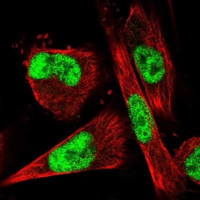 Immunocytochemistry/Immunofluorescence: VEZF1 Antibody [NBP1-84301] - Immunofluorescent staining of human cell line U-251 MG shows localization to nucleoplasm.