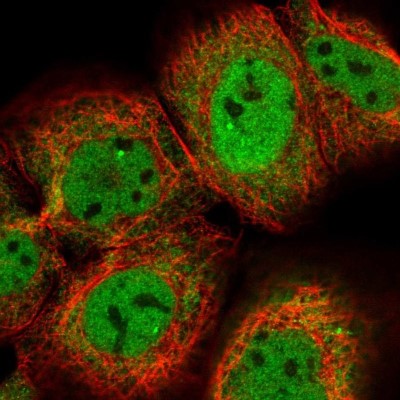 Immunocytochemistry/Immunofluorescence: Cdc14A Antibody [NBP1-84573] - Staining of human cell line A-431 shows localization to nucleoplasm, nuclear bodies & cytosol.