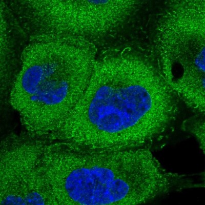 Immunocytochemistry/Immunofluorescence: 26S proteasome subunit 9 Antibody [NBP2-47561] - Immunofluorescent staining of human cell line A-431 shows localization to plasma membrane & cytosol.
