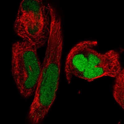 Immunocytochemistry/Immunofluorescence: SMC2 Antibody [NBP2-49655] - Immunofluorescent staining of human cell line RH-30 shows localization to nucleus.