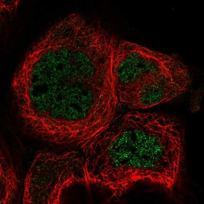 Immunocytochemistry/Immunofluorescence: RABGGTA Antibody [NBP1-87197] - Immunofluorescent staining of human cell line A-431 shows localization to nucleoplasm.