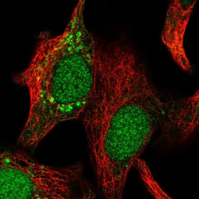 Immunocytochemistry/Immunofluorescence: IMPA2 Antibody [NBP1-86352] - Immunofluorescent staining of human cell line A549 shows localization to nucleoplasm & mitochondria.
