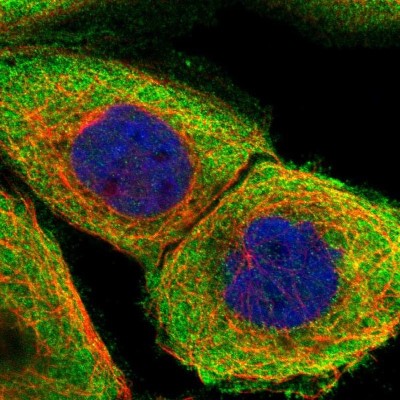 Immunocytochemistry/Immunofluorescence: PPP2R1B Antibody [NBP1-87251] - Immunofluorescent staining of human cell line A-431 shows localization to plasma membrane & cytosol.