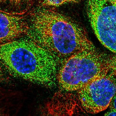 Immunocytochemistry/Immunofluorescence: MBOAT2 Antibody [NBP1-82236] - Staining of human cell line A-431 shows positivity in cytoplasm.