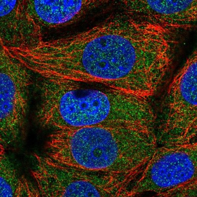 Immunocytochemistry/Immunofluorescence: TOMM34 Antibody [NBP2-38810] - Immunofluorescent staining of human cell line MCF7 shows localization to cytosol.