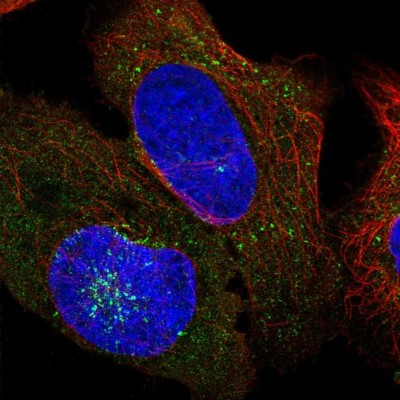 Immunocytochemistry/Immunofluorescence: AFTPH Antibody [NBP2-38227] - Immunofluorescent staining of human cell line U-2 OS shows localization to cytosol, the Golgi apparatus & vesicles.