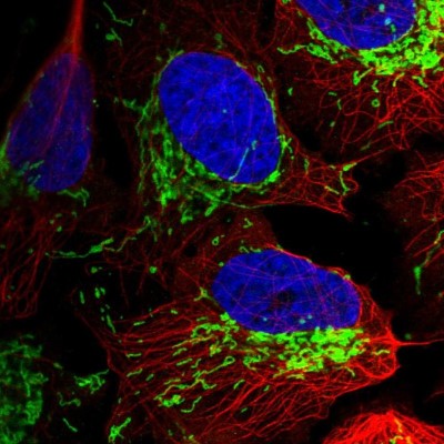 Immunocytochemistry/Immunofluorescence: TOM70 Antibody [NBP2-38571] - Immunofluorescent staining of human cell line U-2 OS shows localization to mitochondria.