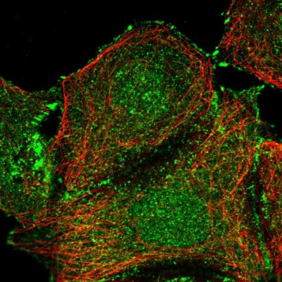 Immunocytochemistry/Immunofluorescence: EIF2B2 Antibody [NBP2-38572] - Immunofluorescent staining of human cell line MCF7 shows localization to nucleoplasm, plasma membrane & focal adhesion sites.