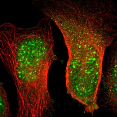Immunocytochemistry/Immunofluorescence: Elongin A Antibody [NBP1-87040] - Immunofluorescent staining of human cell line U-2 OS shows localization to nuclear speckles & cytosol.