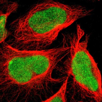 Immunocytochemistry/Immunofluorescence: C1orf174 Antibody [NBP1-87116] - Immunofluorescent staining of human cell line U-2 OS shows localization to nucleus.