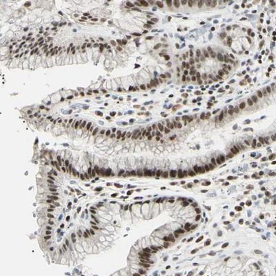 Immunohistochemistry-Paraffin: C1orf174 Antibody [NBP1-87116] - Staining of human stomach shows moderate nuclear positivity in glandular cells.