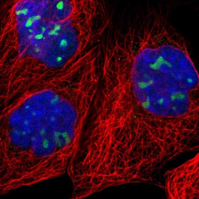 Immunocytochemistry/Immunofluorescence: RRP1 Antibody [NBP1-85339] - Immunofluorescent staining of human cell line A-431 shows localization to nucleoli.