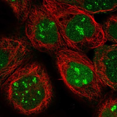 Immunocytochemistry/Immunofluorescence: Phosphopantothenate-cysteine ligase Antibody [NBP1-87398] - Staining of human cell line A-431 shows localization to nucleus & nucleoli fibrillar center.