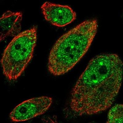 Immunocytochemistry/Immunofluorescence: MSANTD2 Antibody [NBP1-93931] - Staining of human cell line PC-3 shows positivity in nucleus but excluded from the nucleoli.