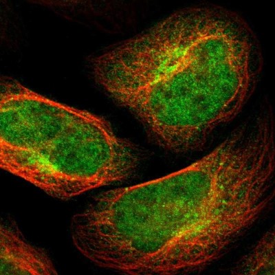 Immunocytochemistry/Immunofluorescence: TSPAN9 Antibody [NBP1-81003] - Staining of human cell line U-2 OS shows localization to nucleoplasm, cytosol & the Golgi apparatus.
