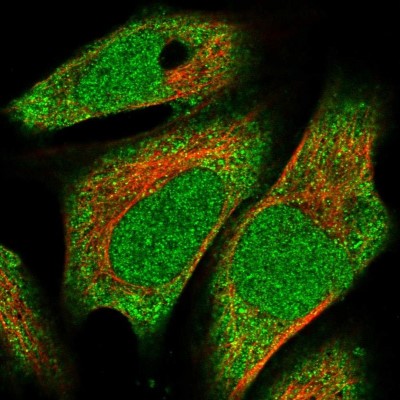 Immunocytochemistry/Immunofluorescence: METT10D Antibody [NBP1-81239] - Immunofluorescent staining of human cell line U-2 OS shows localization to nucleoplasm & cytosol.