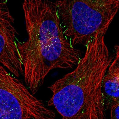 Immunocytochemistry/Immunofluorescence: DNAJC18 Antibody [NBP1-81137] - Staining of human cell line U-2 OS shows positivity in cytoplasm and cell junctions.