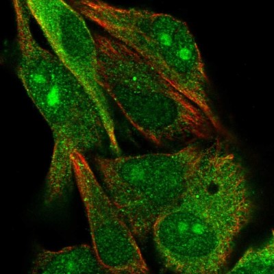 Immunocytochemistry/Immunofluorescence: GYG2 Antibody [NBP2-39032] - Immunofluorescent staining of human cell line SK-MEL-30 shows localization to nucleus, nucleoli & cytosol.