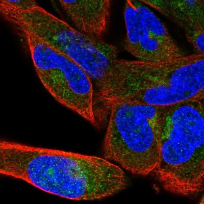 Immunocytochemistry/Immunofluorescence: beta COP Antibody [NBP2-39027] - Immunofluorescent staining of human cell line RH-30 shows localization to cytosol & the Golgi apparatus.